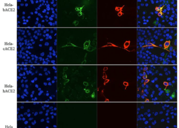 Több mint 80 klinikai vizsgálatot kezdtek Kínában a koronavírus gyógymódjának megtalálására