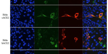 Több mint 80 klinikai vizsgálatot kezdtek Kínában a koronavírus gyógymódjának megtalálására