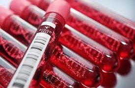 A rák több mint 50 típusát mutatja ki egy új vérvizsgálat