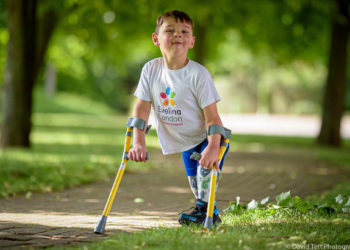 Egy amputált lábú ötéves brit fiú egymillió fontot gyűjtött az életét megmentő kórháznak