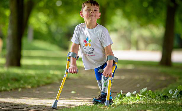 Egy amputált lábú ötéves brit fiú egymillió fontot gyűjtött az életét megmentő kórháznak