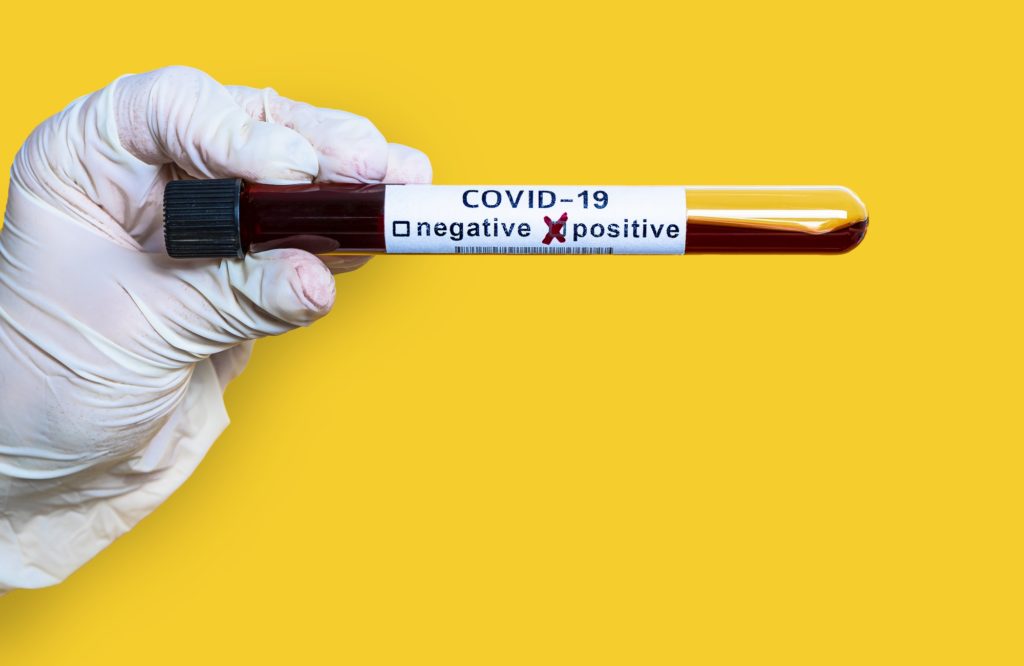 Hand holds a test tube containing a blood sample test tube for Covid-19 coronavirus analyzing
