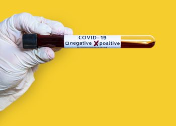 Hand holds a test tube containing a blood sample test tube for Covid-19 coronavirus analyzing