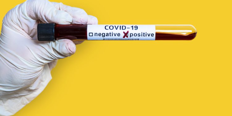 Hand holds a test tube containing a blood sample test tube for Covid-19 coronavirus analyzing