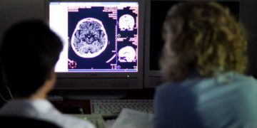 A Semmelweis Egyetem orvosai online tanítják a stroke tüneteinek felismerését