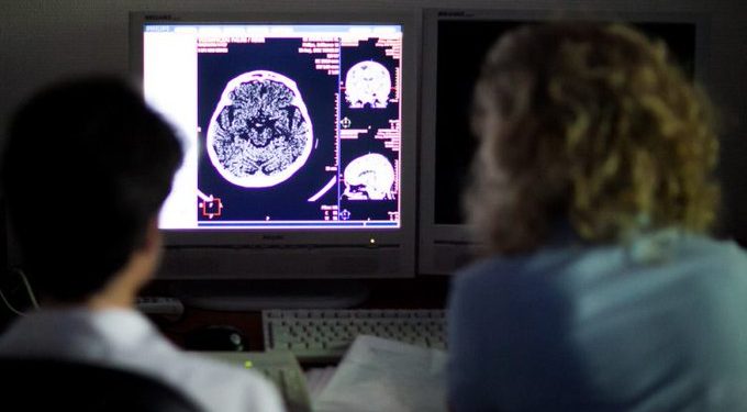 A Semmelweis Egyetem orvosai online tanítják a stroke tüneteinek felismerését