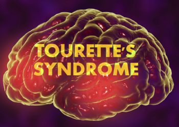 A szegedi kutatók Tourette-szindrómás gyerekek tanulási képességeit vizsgálták