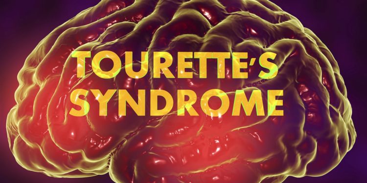 A szegedi kutatók Tourette-szindrómás gyerekek tanulási képességeit vizsgálták