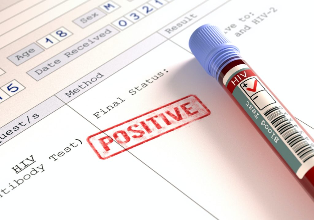 HIV Positive