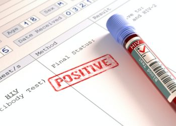 HIV Positive