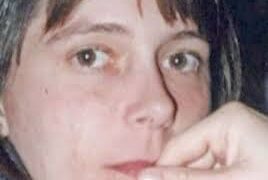 Második arcátültetésen esett át egy nő